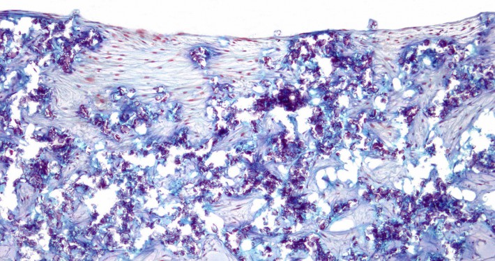 CERASORB-M-Granulate
